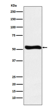 Lumican Rabbit mAb Antibody