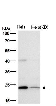 GLO1 Rabbit mAb Antibody