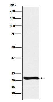 GLO1 Rabbit mAb Antibody