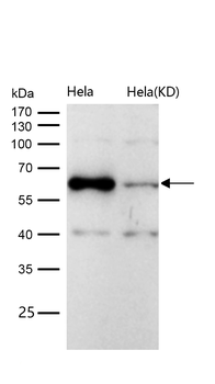 CBS Rabbit mAb [KD Validated] Antibody