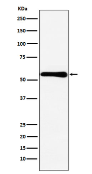CBS Rabbit mAb [KD Validated] Antibody