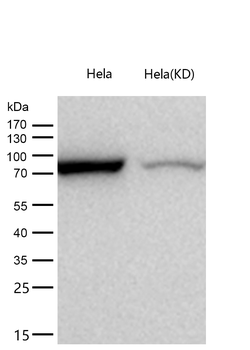 RRM1 Rabbit mAb [KD Validated] Antibody