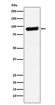 RRM1 Rabbit mAb [KD Validated] Antibody