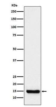 TTC11 Rabbit Monoclonal Antibody