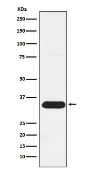 Syntenin Rabbit mAb [KD Validated]