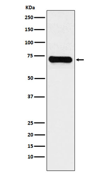 LysRS Rabbit mAb Antibody