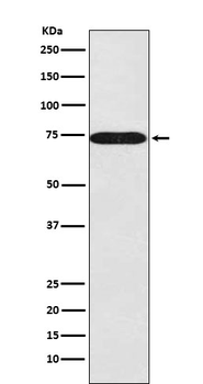 SNX1 Rabbit Monoclonal Antibody