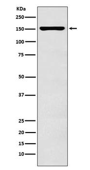 ADAR1 Rabbit mAb Antibody