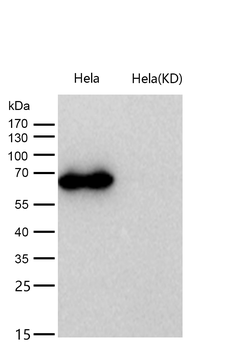 Methionine Aminopeptidase 2 Rabbit mAb [KD Validated] Antibody