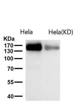 Desmoglein 2 Rabbit Monoclonal Antibody