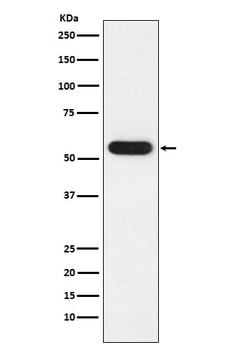 FKBP52 Rabbit mAb Antibody