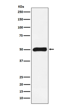 FKBP51 Rabbit mAb Antibody