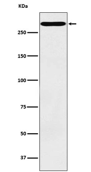 CD35 Rabbit mAb Antibody
