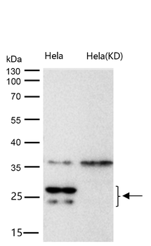 COMT Rabbit mAb [KD Validated] Antibody