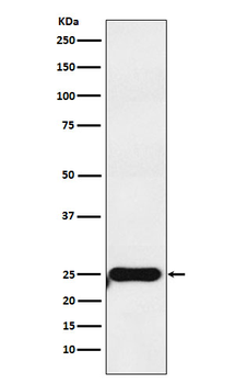 COMT Rabbit mAb [KD Validated] Antibody