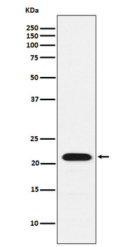 CBFb Rabbit mAb [KD Validated]