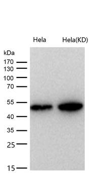 Cytochrome P450 17A1 Rabbit mAb [KD Validated]