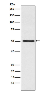 Cytochrome P450 17A1 Rabbit mAb [KD Validated]