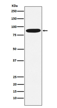 MST1 Rabbit mAb Antibody