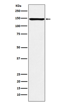 ORP150 Rabbit mAb Antibody