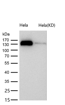 p150 CAF1 Rabbit mAb [KD Validated]
