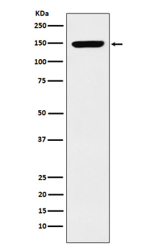 p150 CAF1 Rabbit mAb [KD Validated]