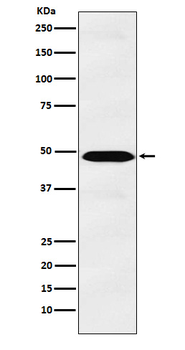 IL13 receptor alpha 1 Rabbit mAb Antibody
