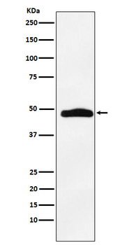 MAPKAP Kinase 2 Rabbit mAb [KD Validated]