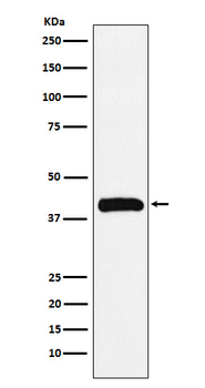 Bub3 Rabbit mAb Antibody
