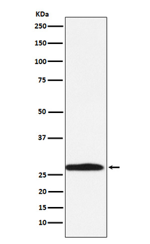Carbonic Anhydrase 1 Rabbit mAb Antibody