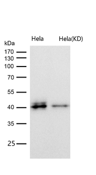 NUDEL Rabbit mAb [KD Validated] Antibody