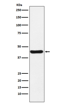 NUDEL Rabbit mAb [KD Validated] Antibody