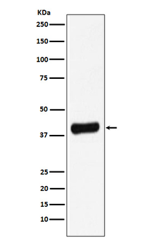 Galectin 8 Rabbit mAb Antibody