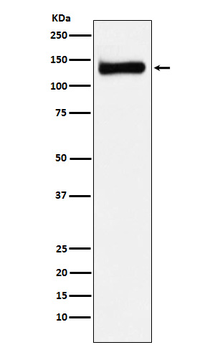 RENT1 / hUPF1 Rabbit mAb Antibody