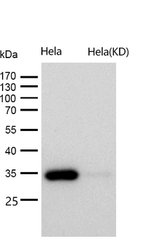 STUB1 Rabbit mAb [KD Validated]