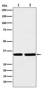 STUB1 Rabbit mAb [KD Validated]