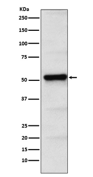 PICK1 Rabbit mAb Antibody
