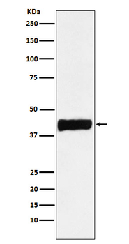 Creatine kinase B type Rabbit mAb Antibody
