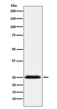 BAP31 Rabbit mAb [KD Validated]