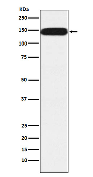 Pumilio 1 Rabbit mAb Antibody