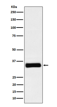 IGFBP2 Rabbit Monoclonal Antibody