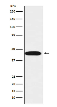 LIS1 Rabbit mAb [KD Validated] Antibody