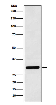 Bcl10 Rabbit mAb Antibody
