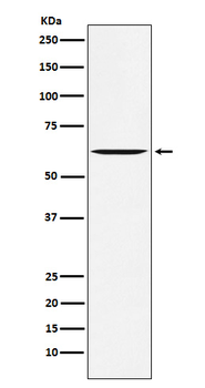 Yes1 Rabbit mAb [KD Validated]