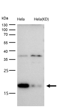 NM23A Rabbit mAb [KD Validated] Antibody