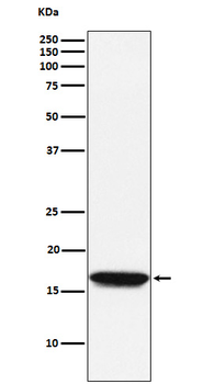 NM23A Rabbit mAb [KD Validated]