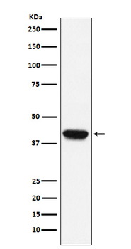 Biglycan Rabbit mAb Antibody