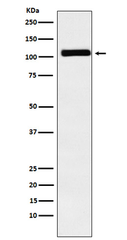 MIB1 / DIP1 Rabbit mAb Antibody