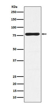 PKC gamma Rabbit mAb Antibody