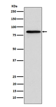 Gelsolin Rabbit mAb Antibody